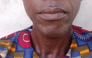 Nahounou Alphonse Dodo